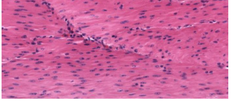 <p>what tissue is this</p>