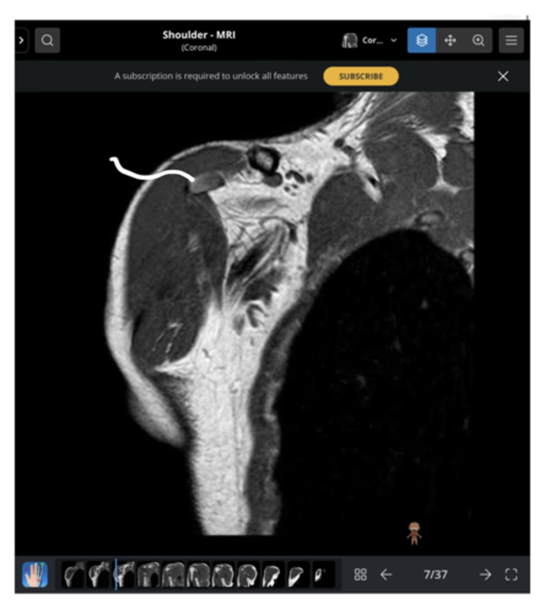 <p>1. What view is this image?</p><p>2. Which structure is being pointed to?</p>