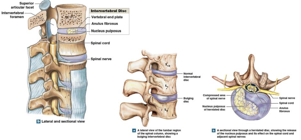 <p>the intervertebral discs outer layer surrounds the </p>