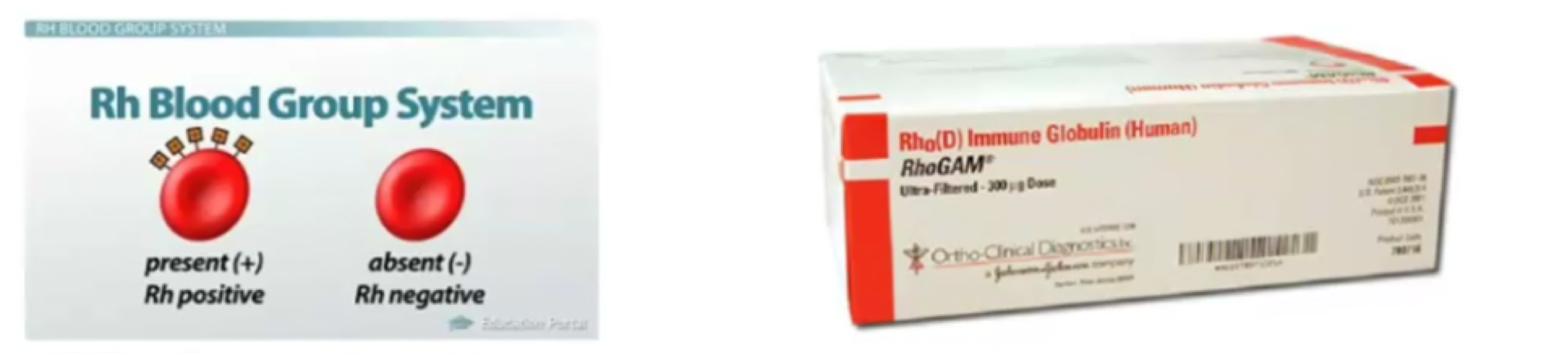 Because mother makes antibodies against the baby’s antigens, at birth problems arise.  