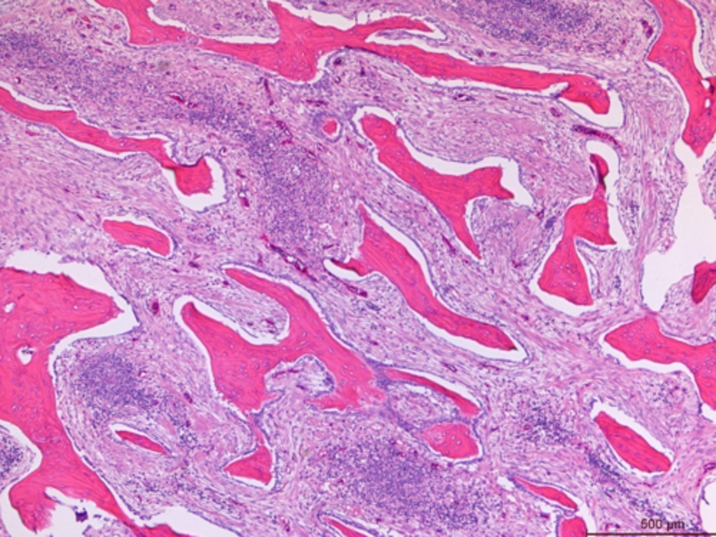 <p>Identify the pathology:</p>