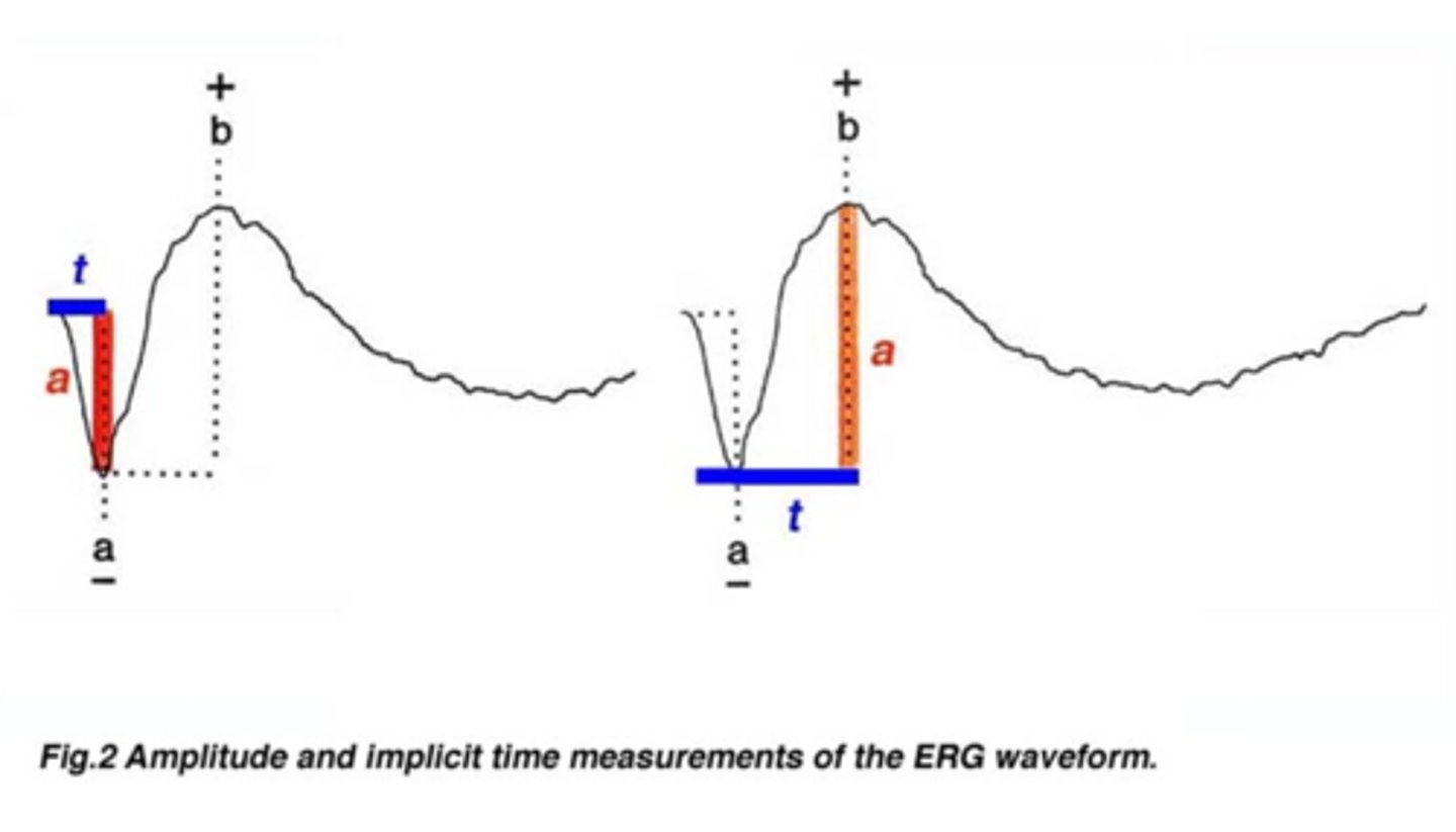 <p>amplitude of a and b wave = often reduced in disease</p><p>implicit time from flash to wave onset = often increased in disease</p>