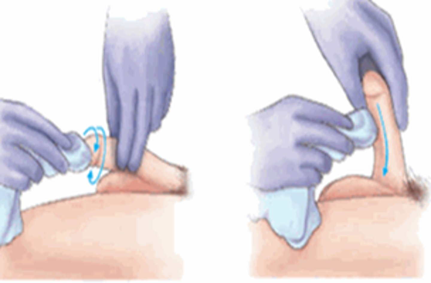 <p>routine procedure to cleanse and perform hygiene on the perineum</p>