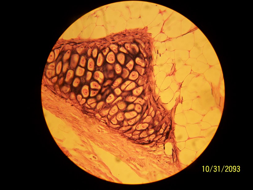 <p>Elastic (Yellow) Cartilage</p>