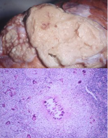 <p>Whats this and causative agent (and how to detect)</p>
