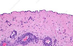 <p>Simple squamous epithelium lining pericardial, pleural, and peritoneal cavities.</p>