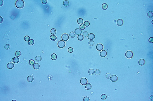 <p>appear smooth, nonnucleated, biconcave disk that is ~7 <span>μm in diameter</span></p>