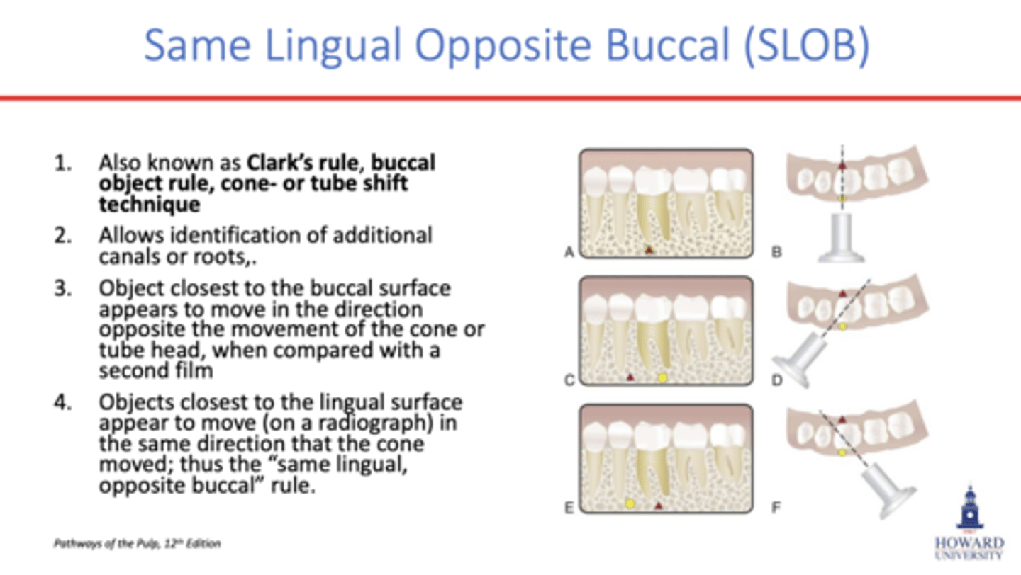 <p>requires 2 radiographs</p><p>all factors remain the same for the second exposure except that tube is shifted 20 degrees mesially/distally</p><p>-the buccal object will appear to have moved in the opposite direction from tube shift</p><p>-the lingual object will appear to have moved in the same direction from tube shift</p>