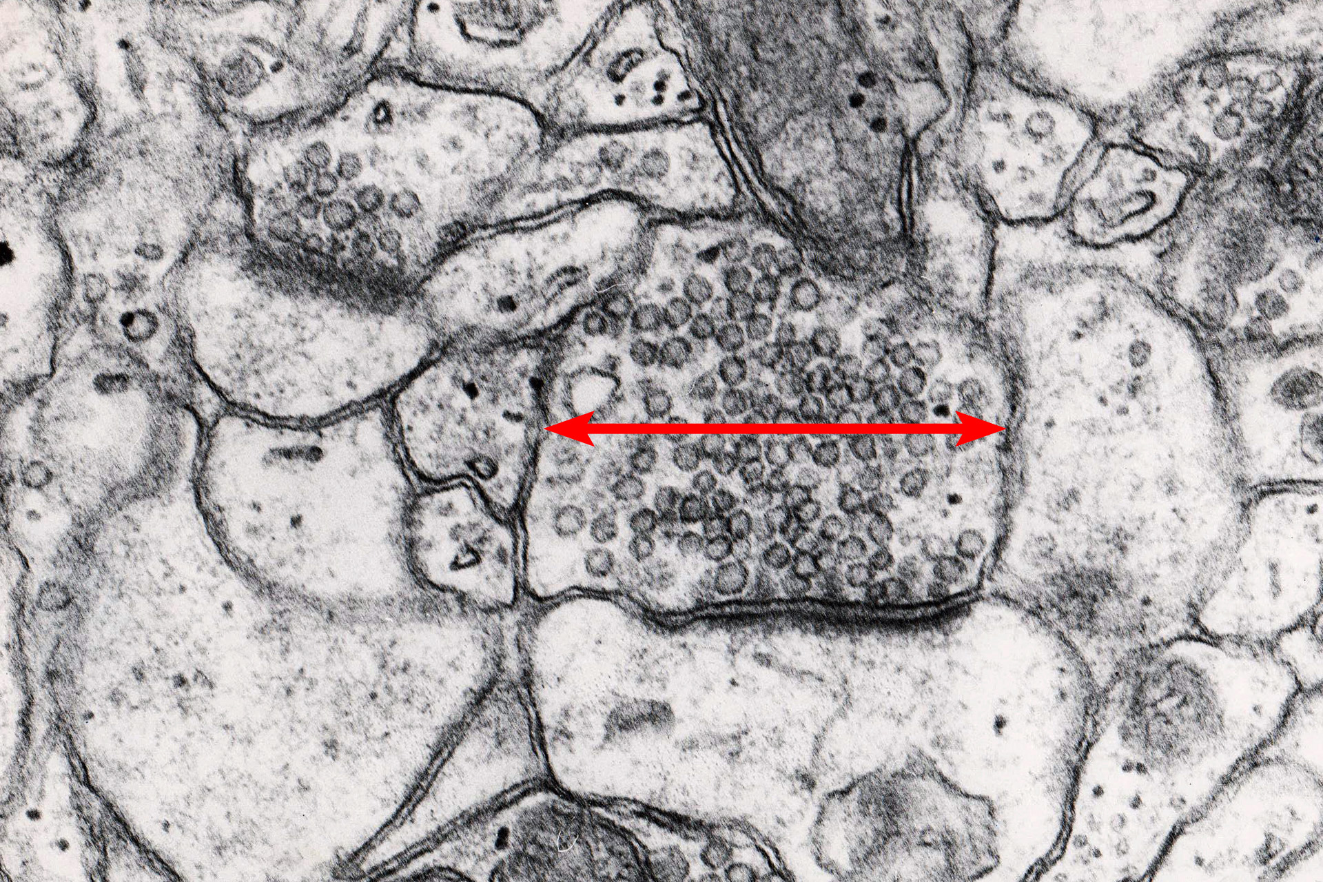 <p>What is this image pointing to?</p>
