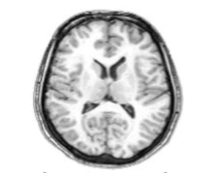 <p>what slice of brain is this?</p>