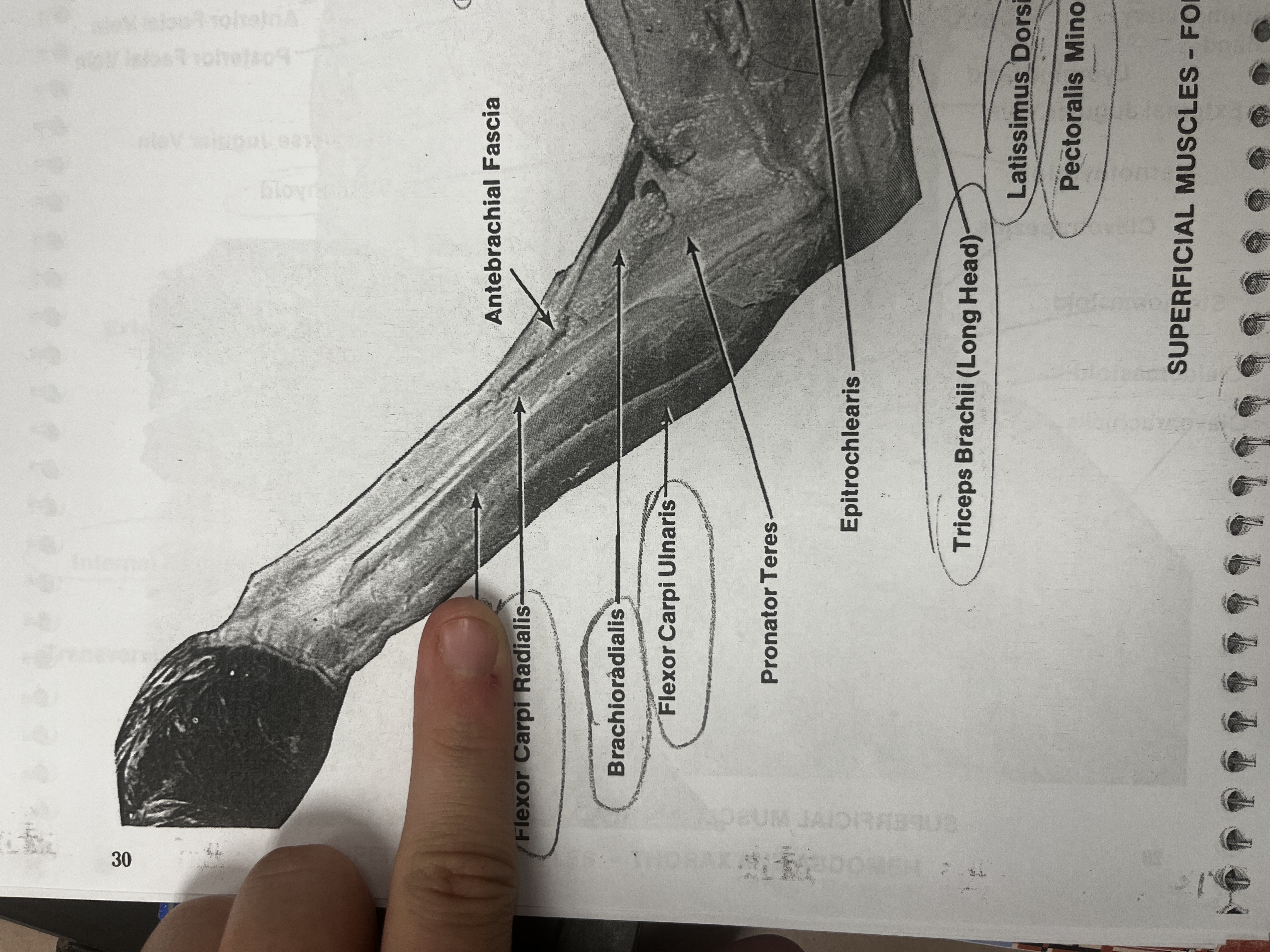 <p>A muscle in the forearm that aids in wrist flexion.</p>