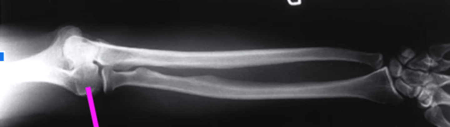 <p>what does this pink line point to?</p>