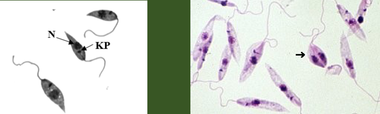 <p>What parasite is this?</p>