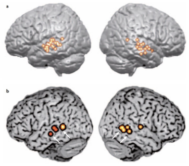 <p>Hickok and Poeppel (2007) - lexical phonological networks in the superior temporal sulcus</p>