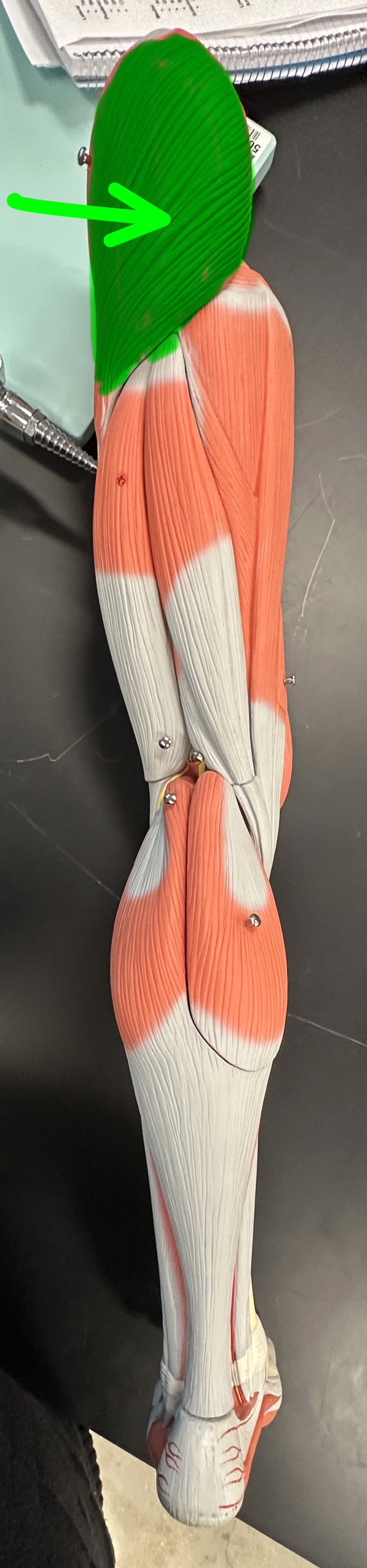 <p>What is the highlighted structure</p>