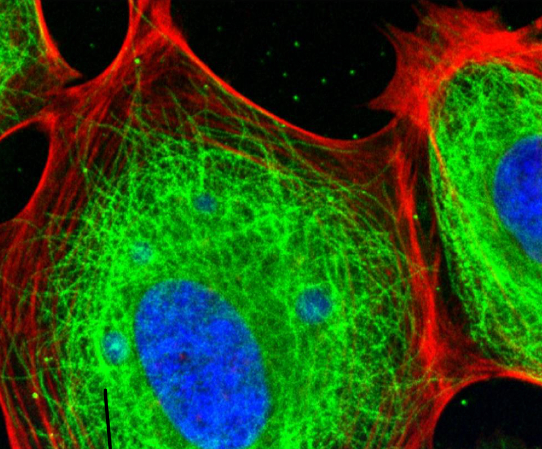 <p>Network of fibers which acts as mechanical support to the cell. Helps a cell maintain its shape. Provides anchorage and reinforcement for many organelles. </p>