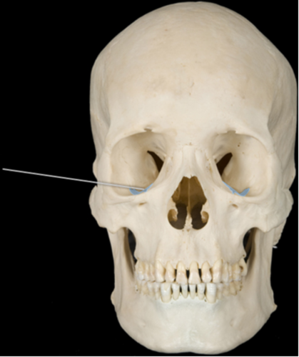 The highlighted openings are primarily formed by which of the following bones?