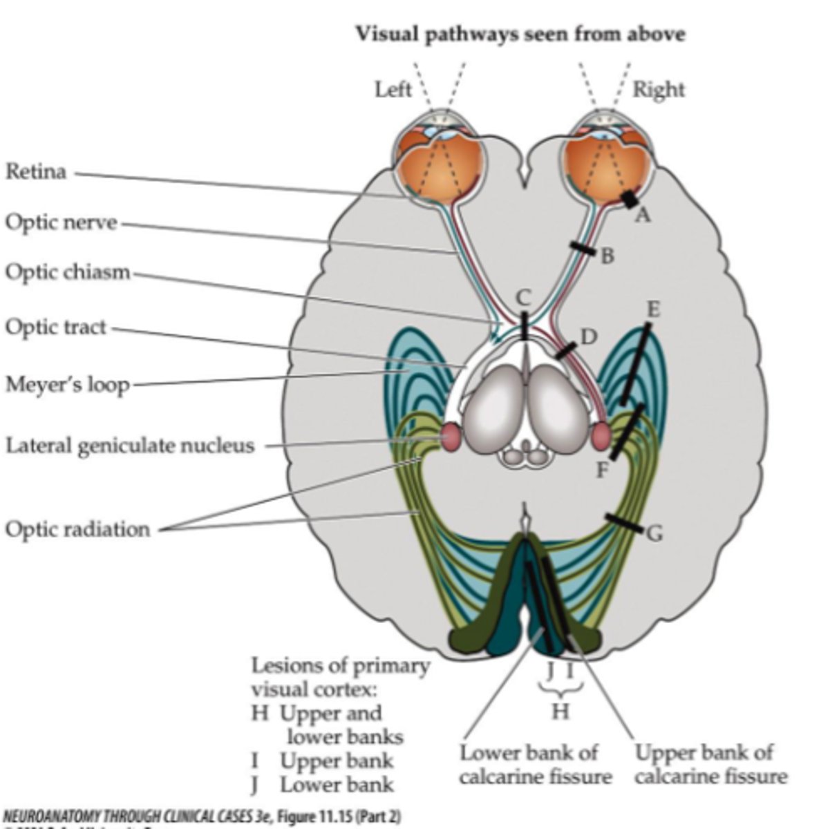 <p>Retina</p>