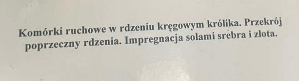 <p> posiada on duży perykarion z dużą ilosćią organelli aby móc szybko syntezować i w odpowiedniej ilości neuroprzekaźniki oraz posiada grube, zmielizowane aksonyu</p>