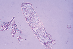 term image