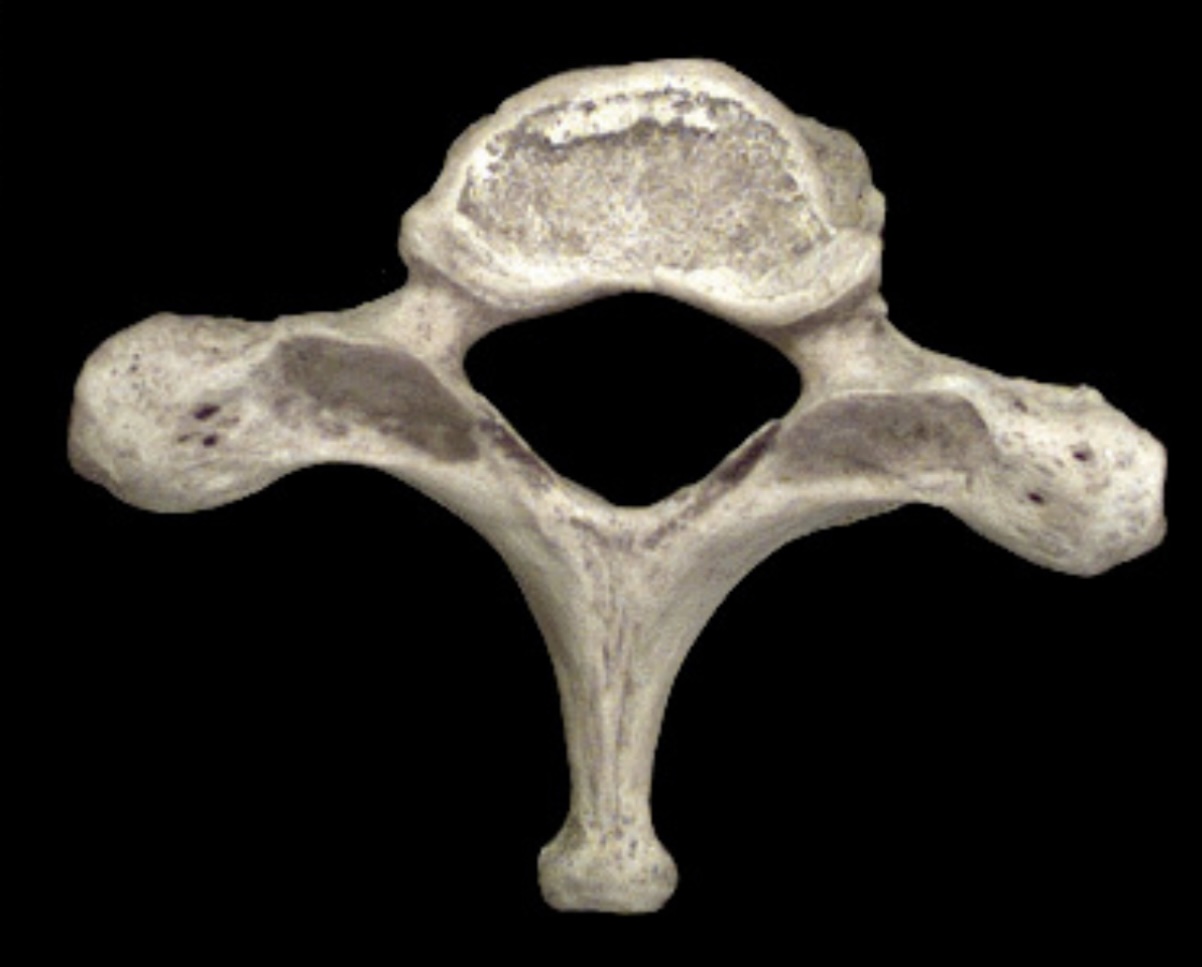 <p>What is this bone?</p>