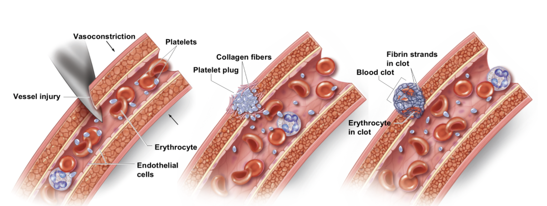 <p><span style="background-color: transparent;"><strong><span>Hemostasis</span></strong></span></p>
