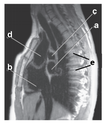 <p>What is letter d ?</p>