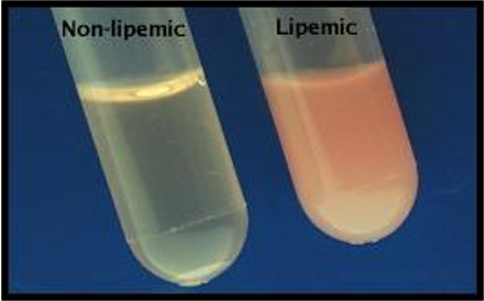 <p>Interfering plasma/serum characteristics that can mislead results.</p>
