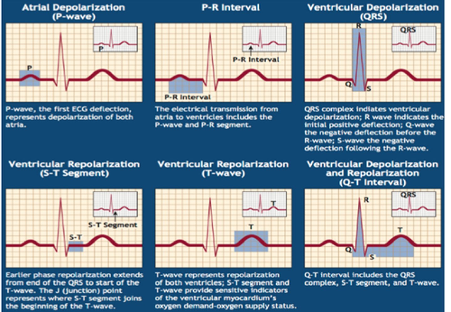 <p>P wave- Atrial Depolarization</p><p>PR segment- AV nodal delay</p><p>QRS complex- Ventricular Depolarization</p><p>QT segment- ventricular systole</p><p>T wave- ventricular repolarization</p><p>TQ interval- Ventricular diastole</p>