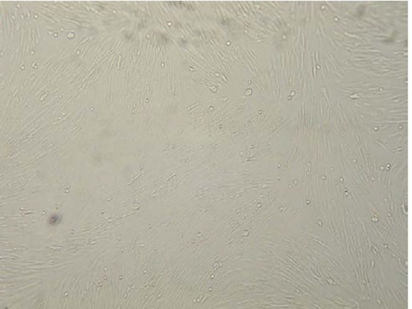 <p>a. Herpes simplex virus</p>