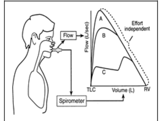 <ul><li><p>intrathoracic pressures become large and position </p><ul><li><p>→ with important implications</p></li></ul></li></ul><p></p>