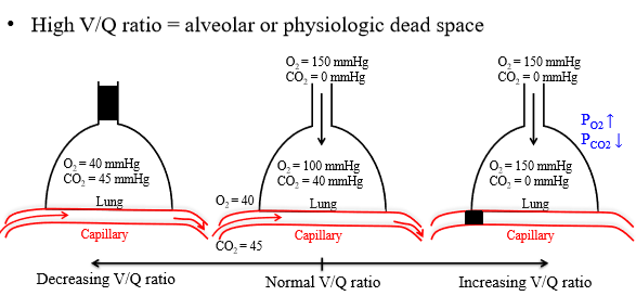 <p>Amount of blood that passes through airway obstruction - venous blood is not oxygenated and not available for gas exchange because of alveolar occlusion</p><p></p>