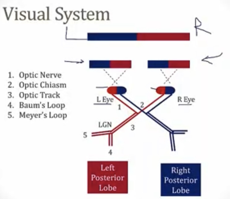 <p>L/R eye</p><p>Optic never</p><p>Optic chiasm</p><p>Optic tract</p><p>LGN</p><p>Splits into Baum’s loop(parietal lobe) and Myer’s loop(temporal lobe)</p>