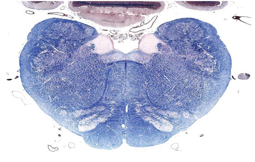 <p>what section of the brain is shown?</p>