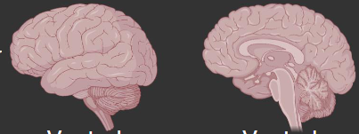 <p>What plane is this brain on?</p>