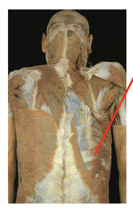 <p>What is this muscle. What is its origin. Where does it inserts. </p>