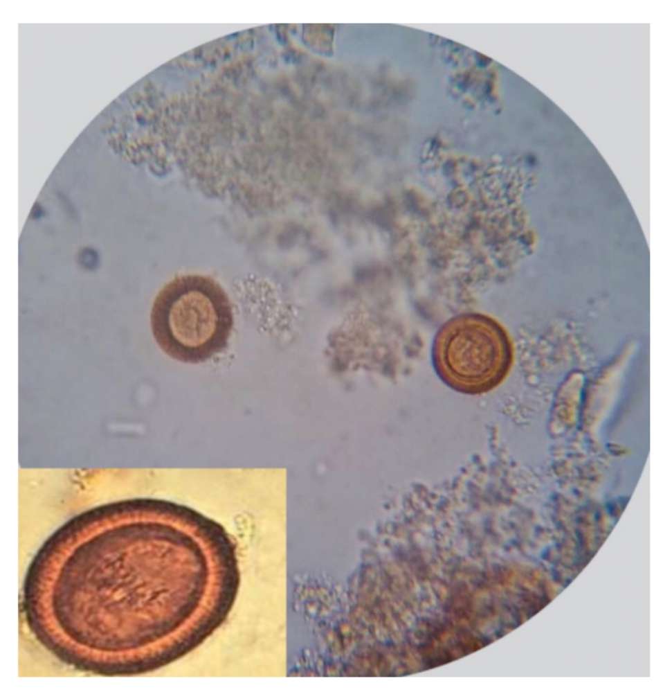 <p>Sobre o(s) ovo(s) na foto, escreva:</p><ul><li><p><strong>NOME CIENTÍFICO</strong> da espécie de parasito</p></li><li><p><strong>FORMA EVOLUTIVA</strong> (+ <strong>SEXO</strong> - <u>se houver</u>)</p></li></ul>