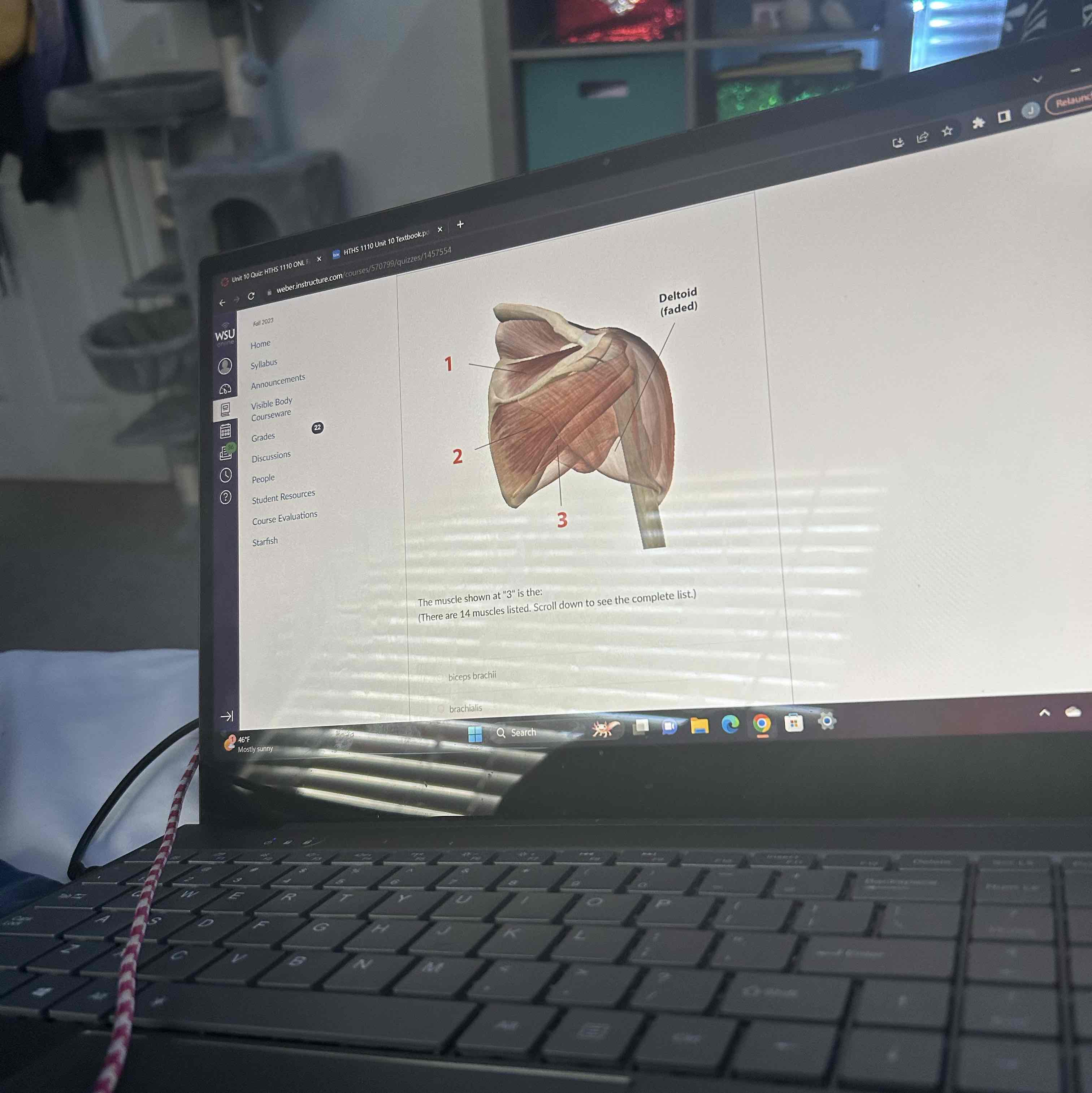 <p>The muscle shown at 1 is the </p>