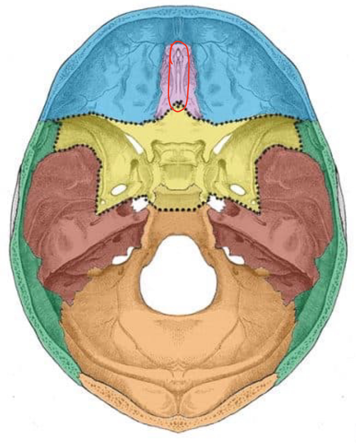 term image