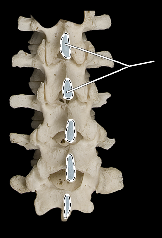 <p>What part of the vertebra is highlighted?</p><p>What region of the vertebral column is this?</p><p>(Posterior view).</p>