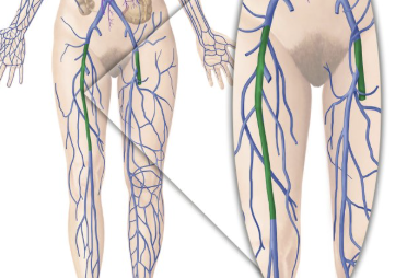 <p>drains blood from upper leg</p>