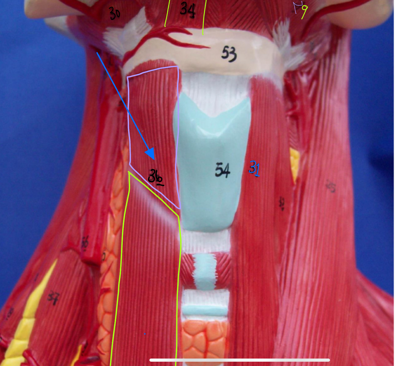 <p>What type of muscle is this ( altay model )</p>