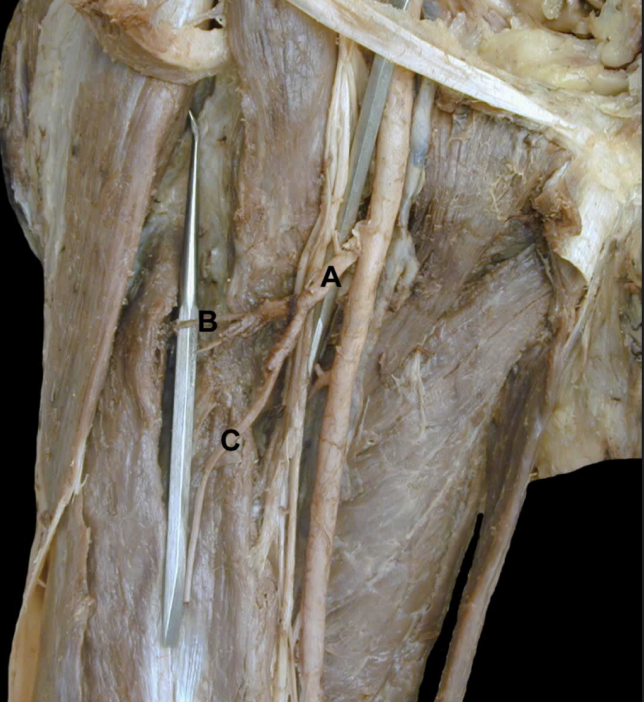 <p>Identify the structures from this<strong>&nbsp;Anterior</strong>&nbsp;<strong>View</strong> of the thigh’s<strong> Lateral Femoral Circumflex Artery &amp; Branches&nbsp;</strong></p>
