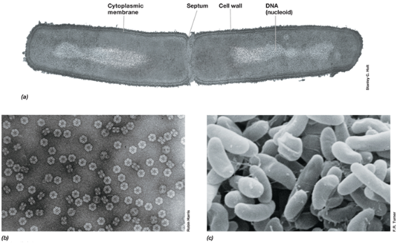 <p>uses a beam of high-energy electrons that can pass through a thin sample to produce a highly magnified image</p>