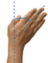 <p>movement of the hand towards the midline in the frontal plane</p>