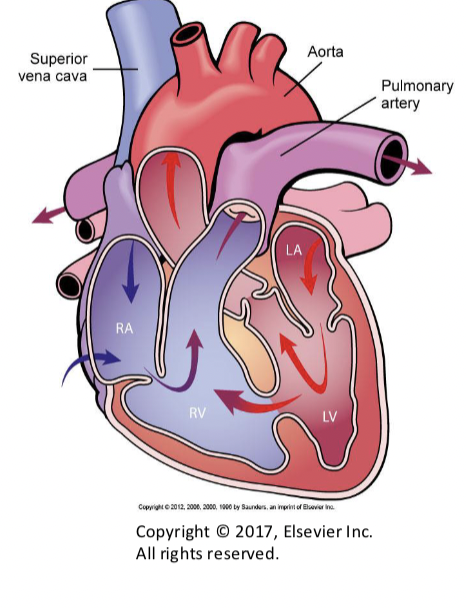 <ul><li><p>most common congenital heart defect in clinical practice</p></li><li><p><strong>left to right shunt</strong></p></li><li><p><strong>right ventricle exceeds the pressure in the left ventricle</strong></p><ul><li><p><strong><u>REVERSES BLOOD FLOW*****</u></strong></p><p></p></li></ul></li></ul><p></p>