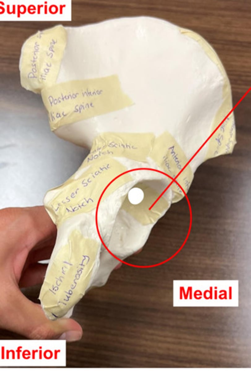 <p>what structure is circled?</p>