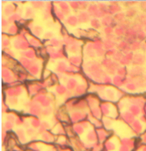 <p>in the spleen, lymph nodes, bone marrow, liver</p>