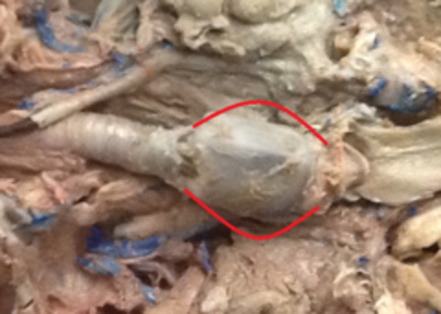 <p>voice box; passageway for air moving from pharynx to trachea; contains vocal cords</p>