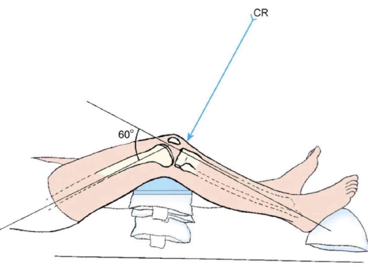 <p>What Projection is this?</p>